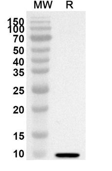 FBN1 Rabbit Polyclonal Antibody