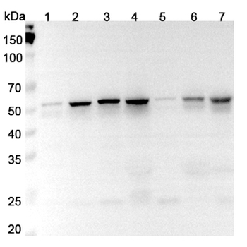 FLI1 Rabbit Polyclonal Antibody