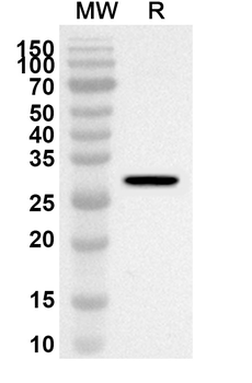 CAPN3 Rabbit Polyclonal Antibody