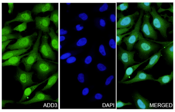 ADD3 Rabbit Polyclonal Antibody