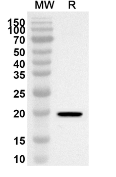 HGS Rabbit Polyclonal Antibody
