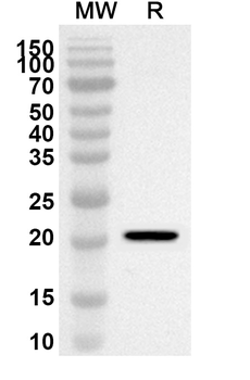 TRIM69 Rabbit Polyclonal Antibody