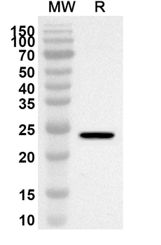SOX10 Rabbit Polyclonal Antibody