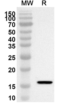 AMOT Rabbit Polyclonal Antibody