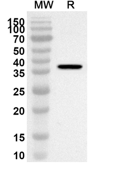PDK2 Rabbit Polyclonal Antibody