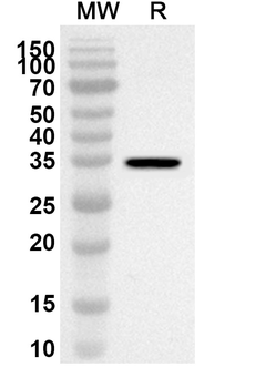 DDX3X Rabbit Polyclonal Antibody