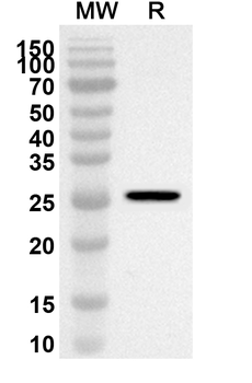 ATF2 Rabbit Polyclonal Antibody