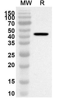 PREB Rabbit Polyclonal Antibody