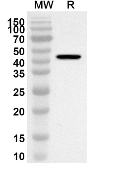 ASIC1 Rabbit Polyclonal Antibody