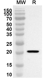HSPB8 Rabbit Polyclonal Antibody