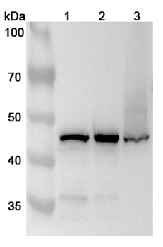 HSDL2 Rabbit Polyclonal Antibody