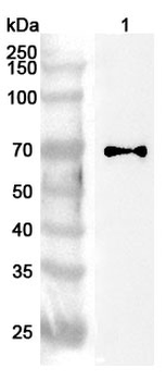 CCDC6 Rabbit Polyclonal Antibody