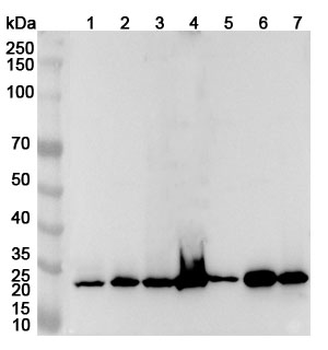 RPA2 Rabbit Polyclonal Antibody