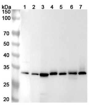 RPA2 Rabbit Polyclonal Antibody