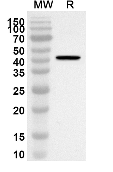 USP21 Rabbit Polyclonal Antibody