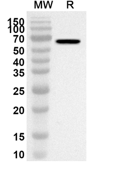 AP1G1 Rabbit Polyclonal Antibody