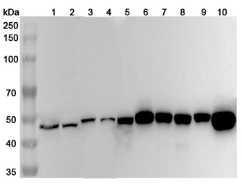 FEN1 Rabbit Polyclonal Antibody