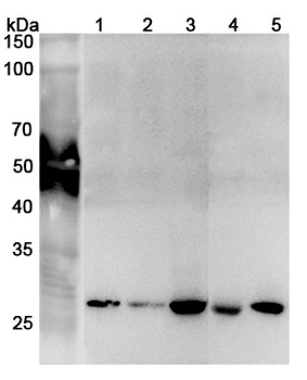 PSMA7 Rabbit Polyclonal Antibody