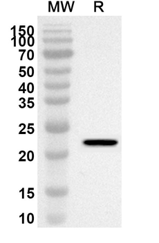 RHEB Rabbit Polyclonal Antibody
