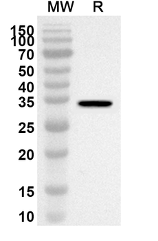 PRKACA Rabbit Polyclonal Antibody