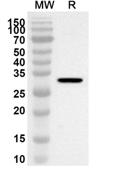 VDAC2 Rabbit Polyclonal Antibody