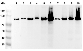 ACO2 Rabbit Polyclonal Antibody