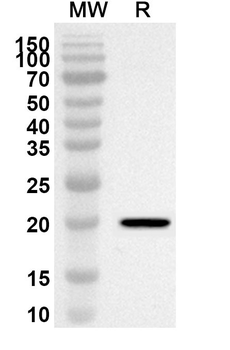 RASSF6 Rabbit Polyclonal Antibody