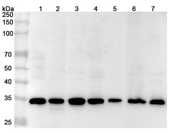STUB1 Rabbit Polyclonal Antibody
