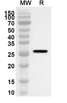 UHRF1 Rabbit Polyclonal Antibody