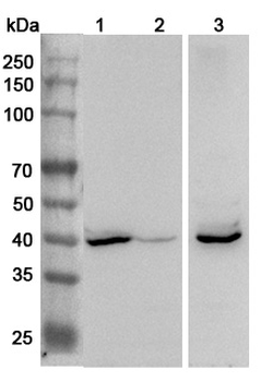 Clostridium perfringens nanH/Sialidase Rabbit Polyclonal Antibody