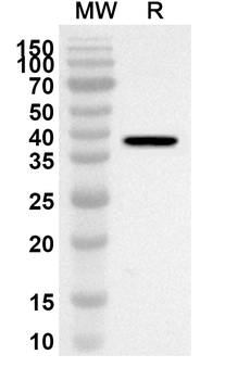PPP2CA Rabbit Polyclonal Antibody