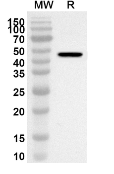 PDK4 Rabbit Polyclonal Antibody