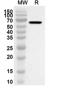 Clostridium perfringens pfo/Perfringolysin O/Theta-toxin Rabbit Polyclonal Antibody
