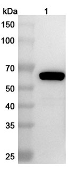 Clostridium perfringens pfo/Perfringolysin O/Theta-toxin Rabbit Polyclonal Antibody