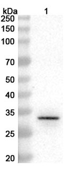 Cutibacterium acnes PPA2105/Triacylglycerol lipase Rabbit Polyclonal Antibody
