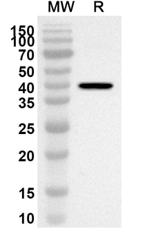 MAP2K7 Rabbit Polyclonal Antibody