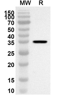 TP63 Rabbit Polyclonal Antibody