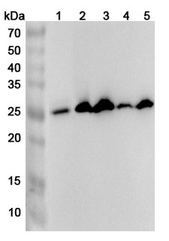 SOSTDC1 Rabbit Polyclonal Antibody