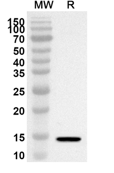 KISS1 Rabbit Polyclonal Antibody