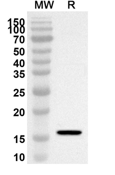 BMPR2 Rabbit Polyclonal Antibody