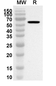 GRIN2A Rabbit Polyclonal Antibody