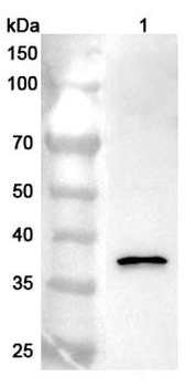 RAD51 Rabbit Polyclonal Antibody
