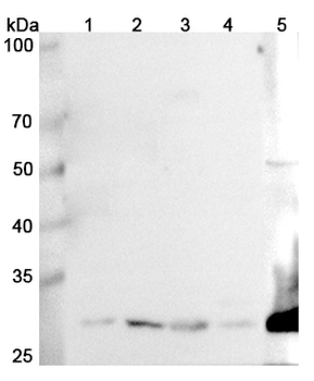 GCLM Rabbit Polyclonal Antibody