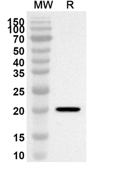 SNCA Rabbit Polyclonal Antibody