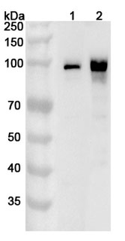 CTNNB1 Rabbit Polyclonal Antibody