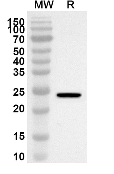 CDC25B Rabbit Polyclonal Antibody
