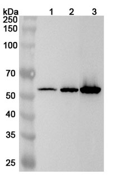 Calreticulin/CALR Rabbit Polyclonal Antibody