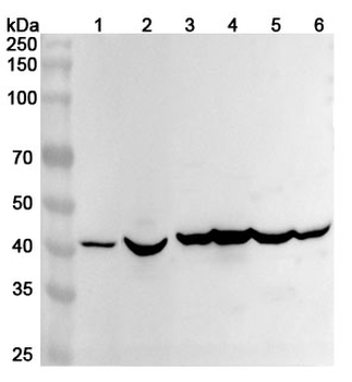 ACAT1 Rabbit Polyclonal Antibody