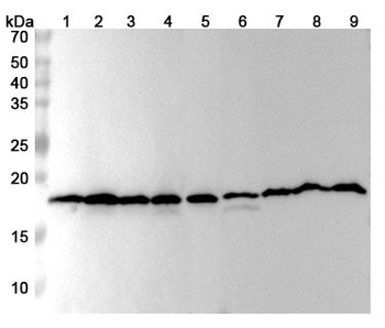 CFL1 Rabbit Polyclonal Antibody