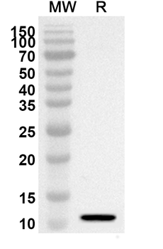RAB5A Rabbit Polyclonal Antibody